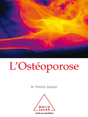 cover image of L' Ostéoporose